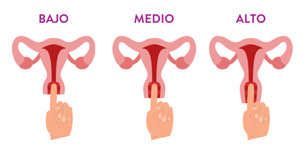 Medir tu cérvix o cuello uterino